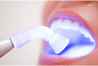 BPA Exposure and Its Surprising Impact on Tooth Enamel Strength
