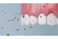 Mondays with Mark: Understanding Plaque and Fluoride Risks