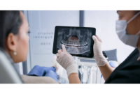 The Cavity Risk Your Dentist Isn’t Asking About — Are You Affected?