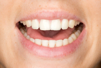 Is Your Mouth Making You Sick? Signs, Risks, and When to See a Dentist