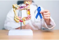 Mouth Symptoms That Could Signal Colon Cancer: What to Watch For