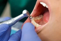 Dentist-Recommended Tips to Keep Teeth White Between Cleanings