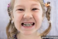 Why Does My Child Have Two Rows of Teeth? Treating Hyperdontia Effectively