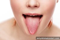 Prevent Oral Thrush: 3 Practical Ways to Prevent Mouth Candida
