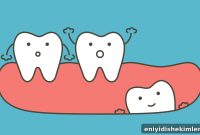 What to Expect When Getting Your Wisdom Teeth Removed