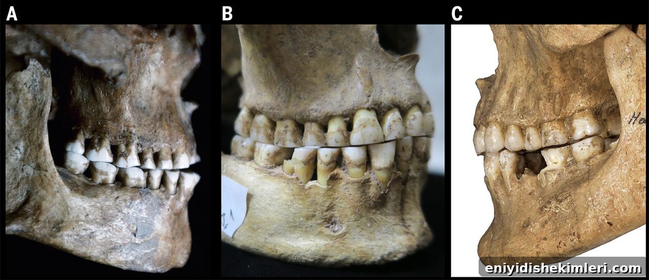 Wisdom Teeth: Photos, Symptoms, Surgery Guide & Pain Relief Tips 3 img 16455 2