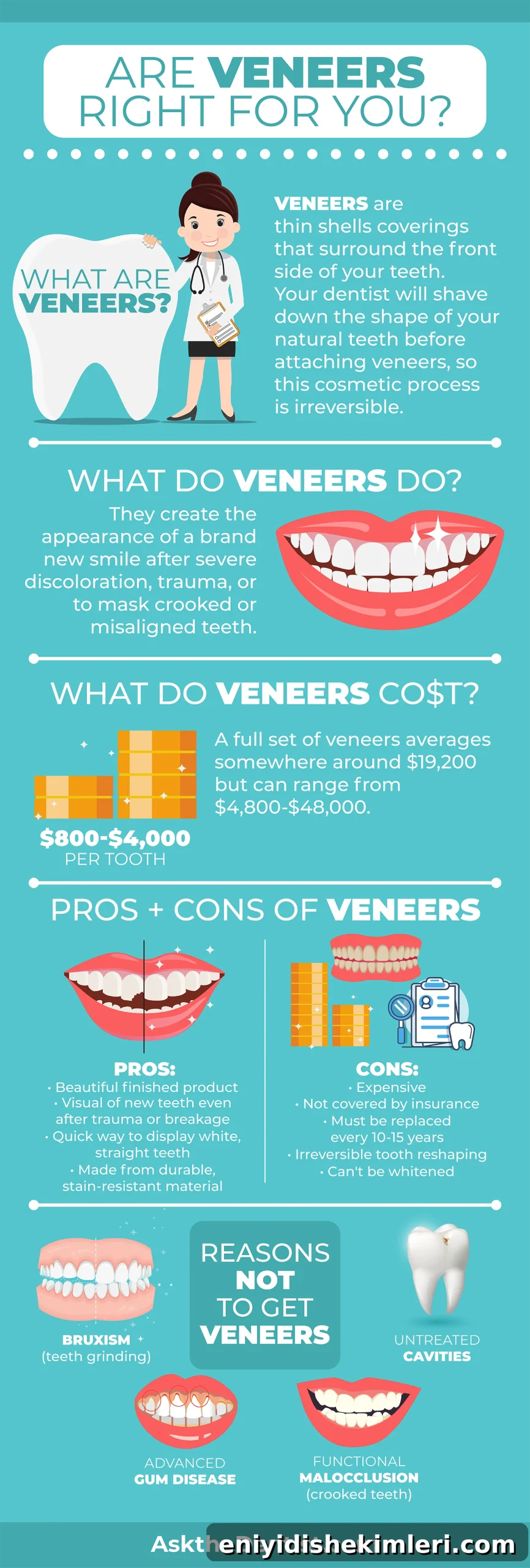 Are Veneers Worth It? Costs, Benefits, Risks, Procedure & FAQs 2 veneers-types-cost-description-pros-cons