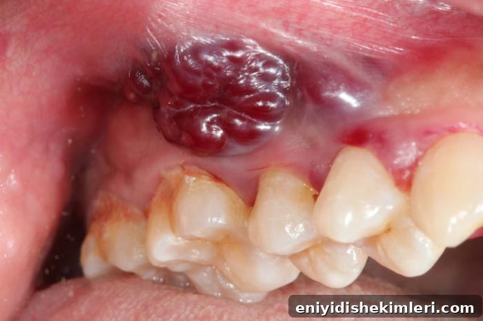 Oral Cancer Guide: Symptoms, Stages, Treatment Options & Prevention 2 img 19907 1