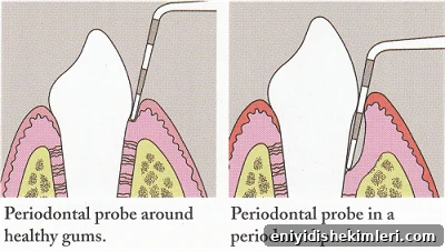Vaping and Oral Health: Dry Mouth, Receding Gums, Bad Breath, Teeth Grinding 2 pocket reading