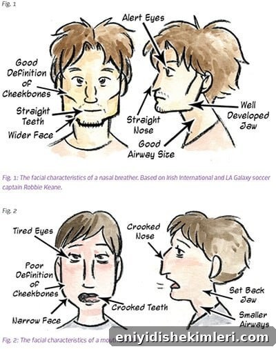 development of mouth breathers
