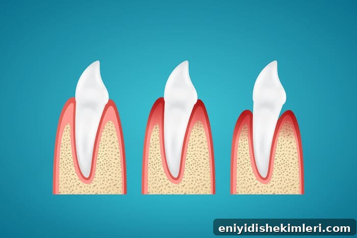 What Happens If You Go to Bed Without Brushing Your Teeth? 3 gum inflammation